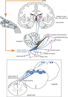 Restoring Somatosensation: Advantages and Current Limitations of Targeting the Brainstem Dorsal Column Nuclei Complex